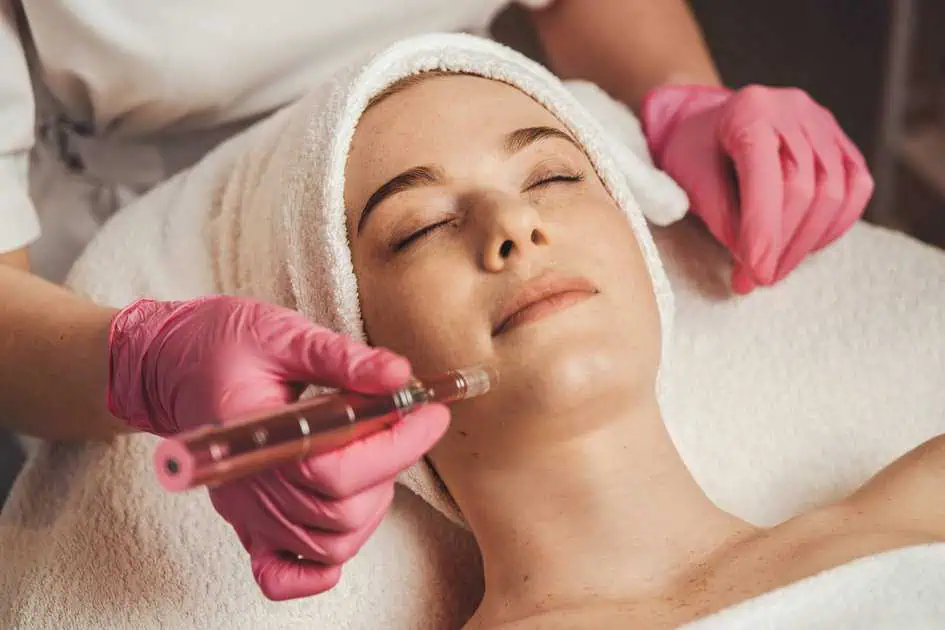 Microneedling treatment for Skin Rejuvenation by Advanced Care & Medsp in Lisle IL