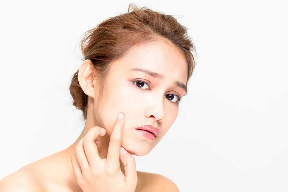 Acne by Advanced Gynecology Practice LLC DBS Advanced Medical in Lisle, IL