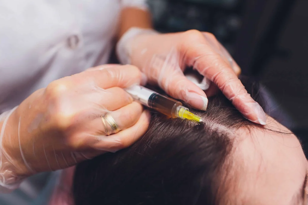 PRP injections in Lisle, IL at Advanced Care & Medspa for scalp health and hair growth