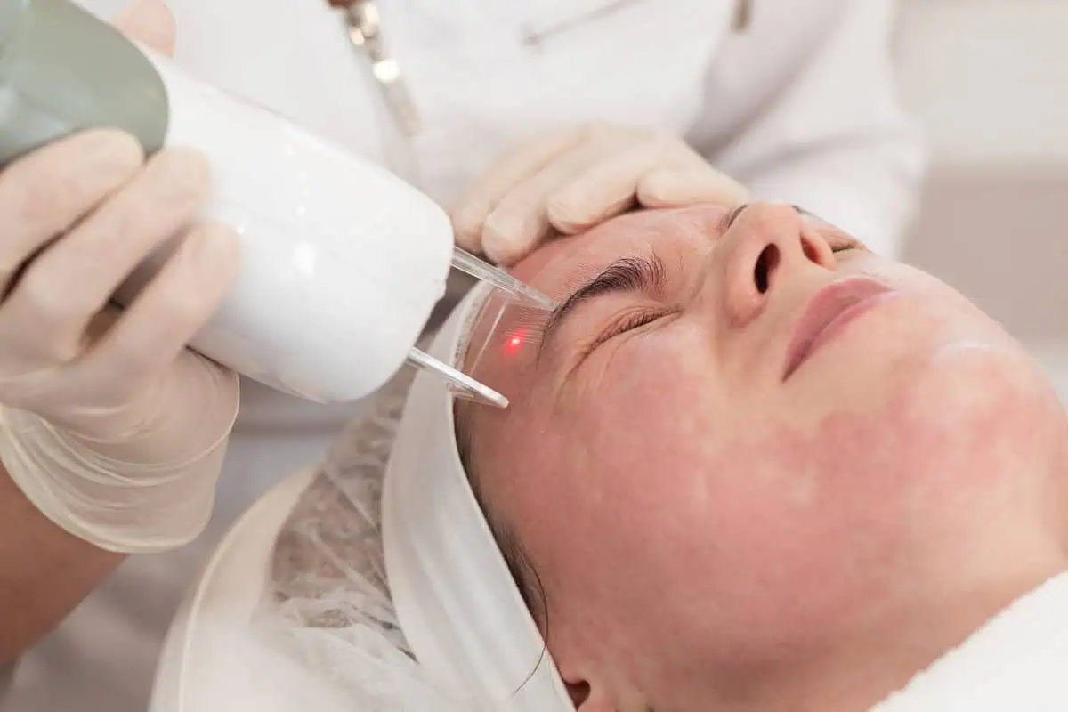 Laser scar reduction | Advanced Care & Medspa | Lisle, IL