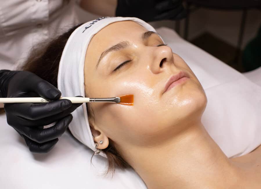 Chemical peel treatments at Advanced Care & Med Spa to help find the best option for your skin type