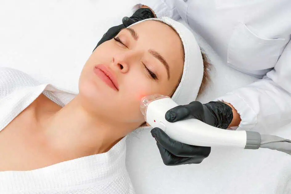 Rosacea Laser Treatment in Lisle, IL by Advanced Gynecology Practice LLC DBS Advanced Medical