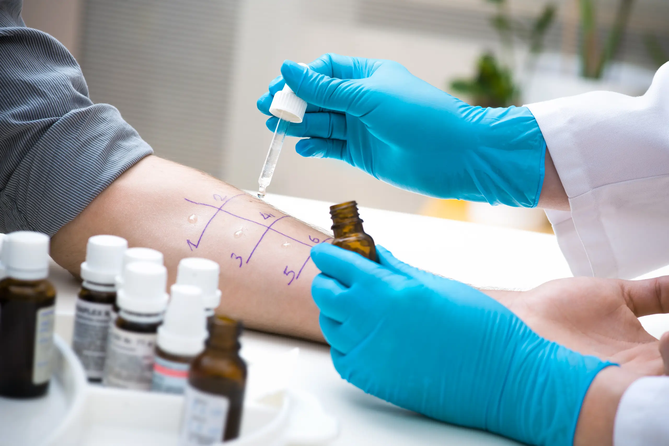 Allergy and gut testing procedure | Medical Spa | Lisle, IL | AdvCare Med Spa