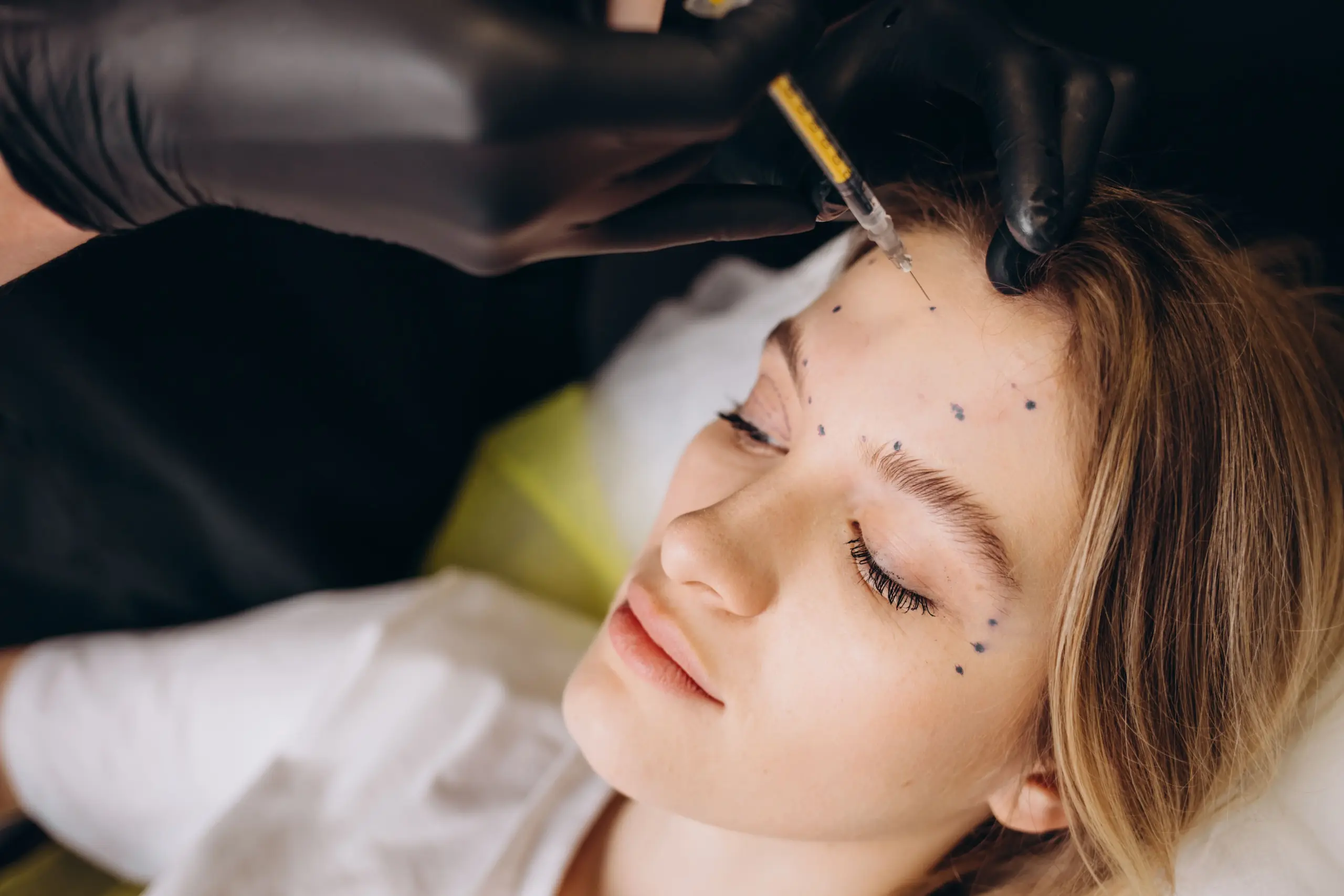 Botox treatment for fine lines | Medical Spa | Lisle, IL | AdvCare Med Spa
